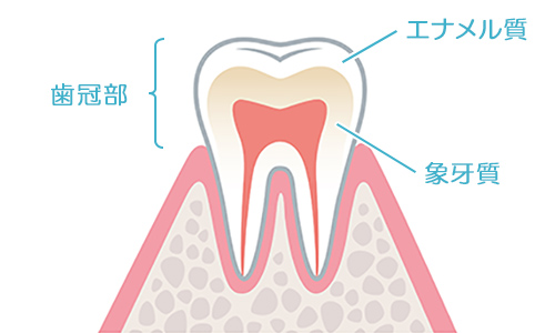 虫歯の症状について