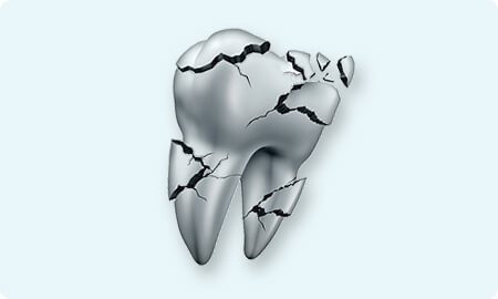 虫歯より怖い歯周病
